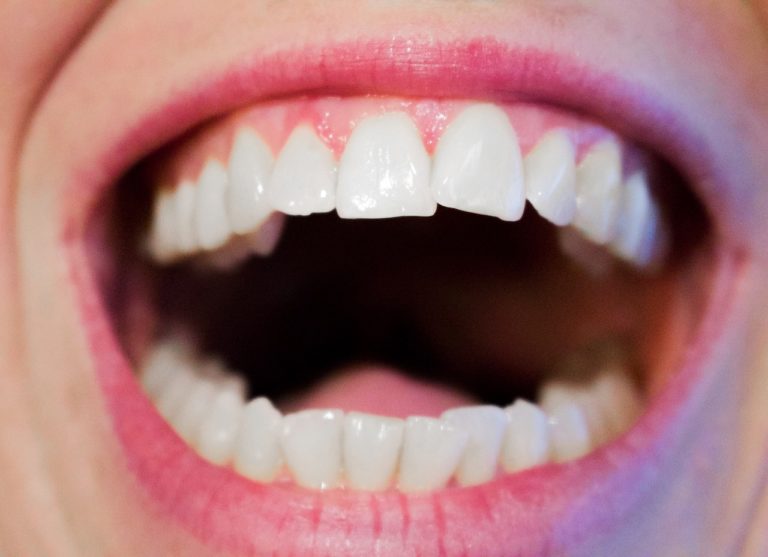 Nowoczesna technika używana w salonach stomatologii estetycznej może spowodować, że odbierzemy śliczny uśmiech.